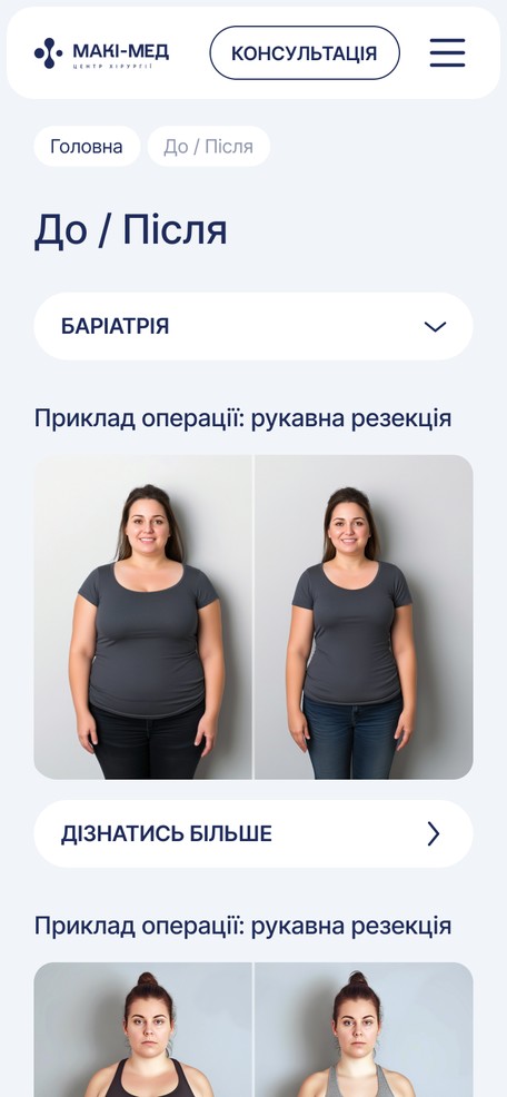 Раздел «До / После»
