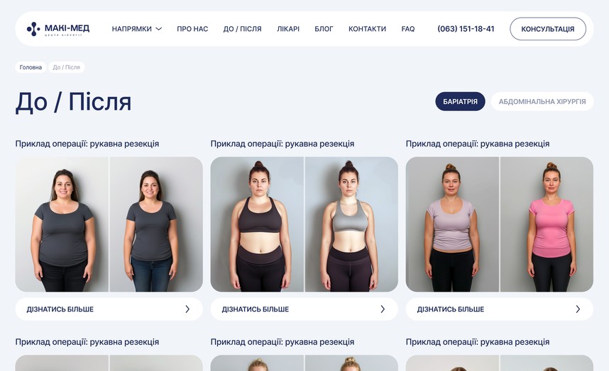 Раздел «До / После»