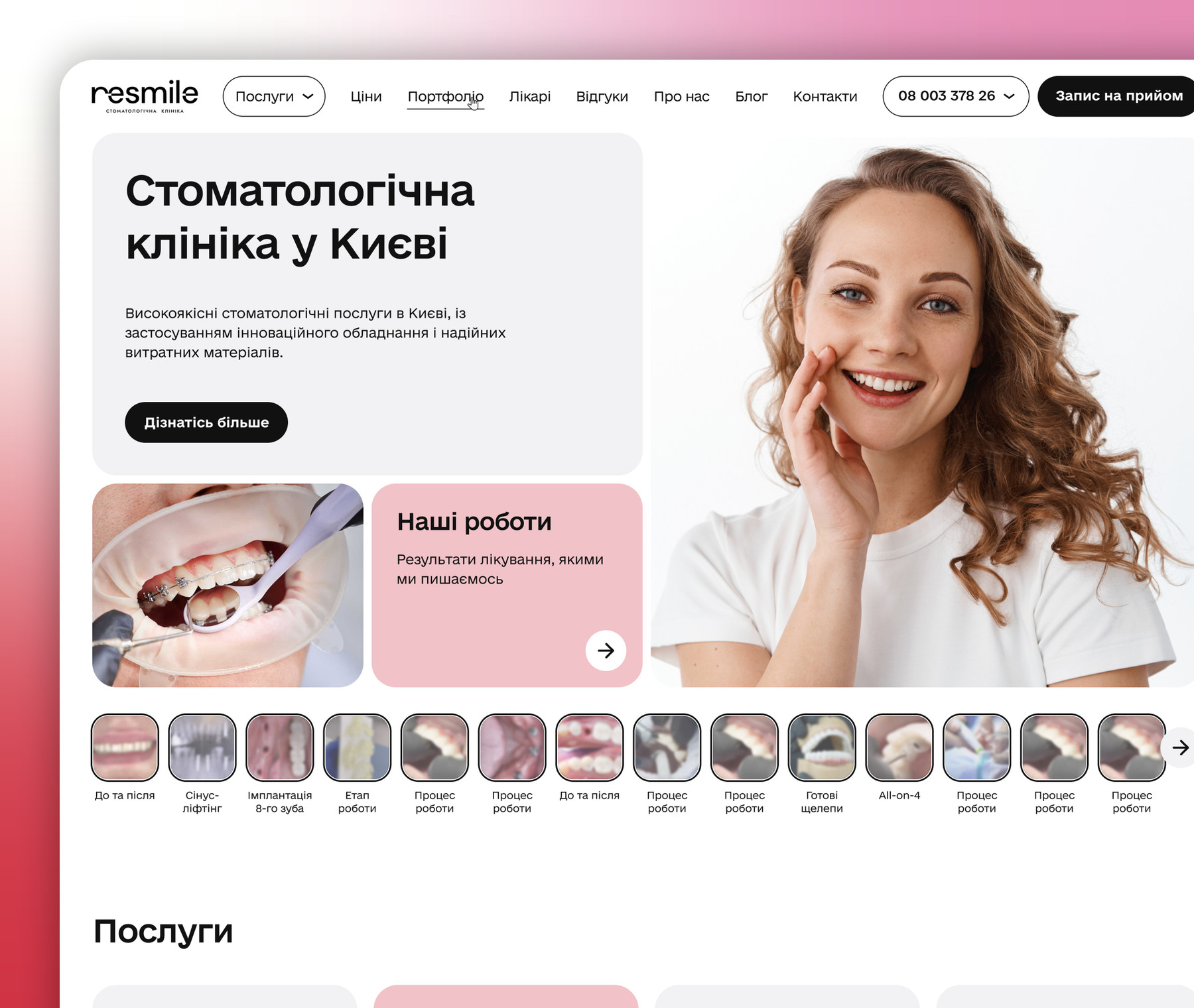 ReSmile https://resmile.com.ua/