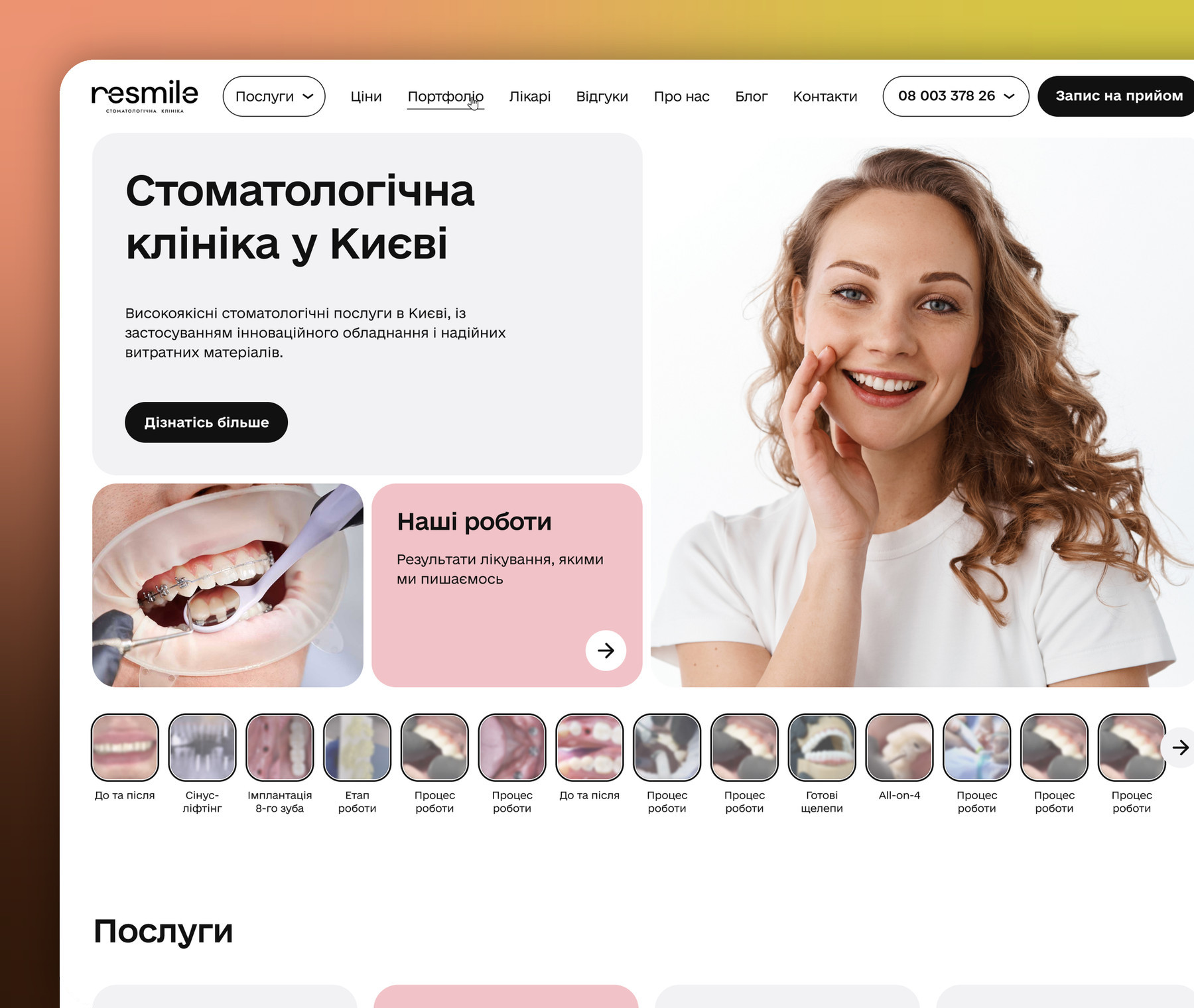 https://resmile.com.ua/